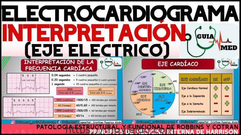 Guía completa para interpretar un electrocardiograma: consejos y pasos clave