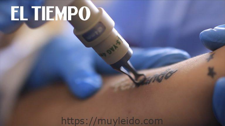 Descubre cómo queda un tatuaje borrado y recupera tu piel sin marcas